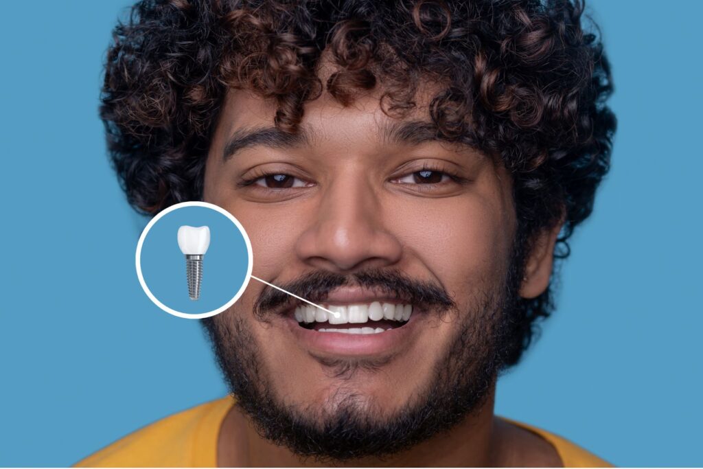 dental implant Jaipur